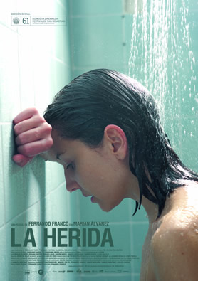 La herida La herida